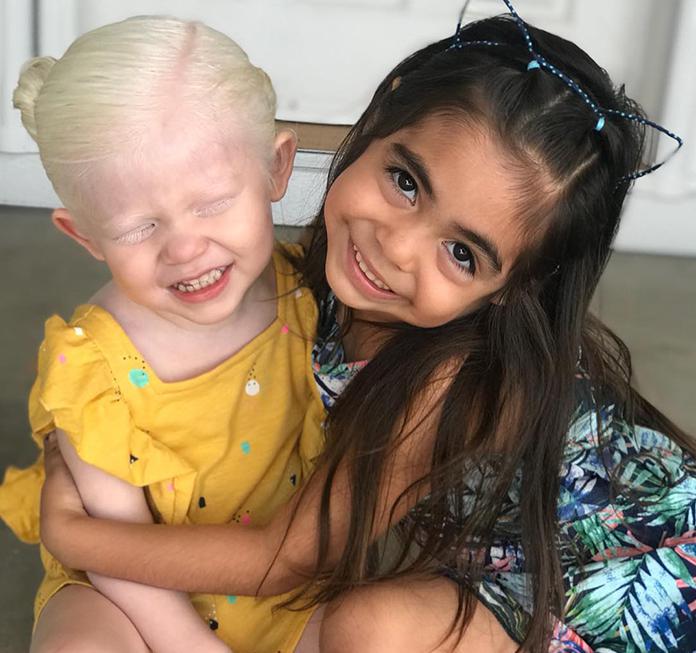 Des parents mexico-américains sont choqués après avoir donné naissance à une petite fille blonde à la peau claire