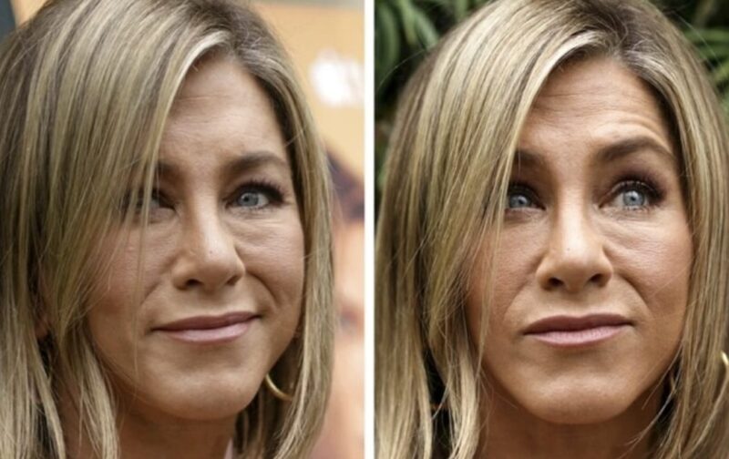 "Altération des traits du visage due à des procédures Inappropriées" : le médecin de Jennifer Aniston commente les changements visibles