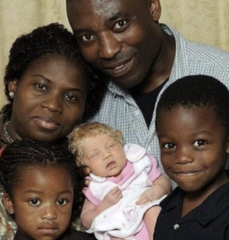 La naissance d'une petite fille 'Blanche-Neige' dans une famille nigériane il y a 10 ans a choqué tout le monde