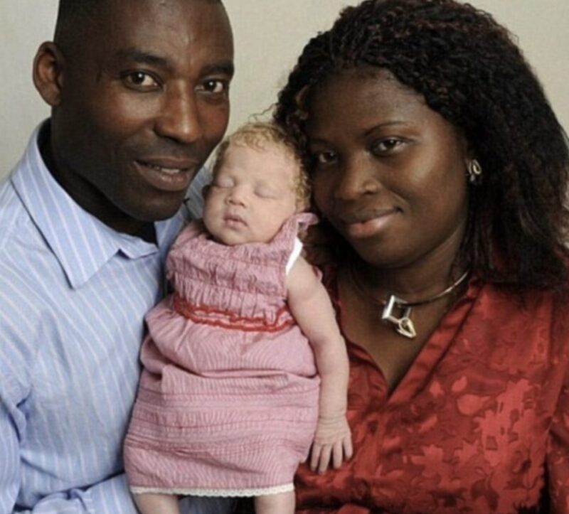La naissance d'une petite fille 'Blanche-Neige' dans une famille nigériane il y a 10 ans a choqué tout le monde