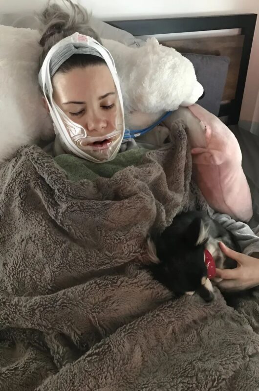 La jeune fille, autrefois moquée pour son "visage de cheval", a osé franchir le pas de la chirurgie esthétique : découvrez ses photos avant et après